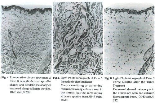 Fig4,Fig5、Fig6写真