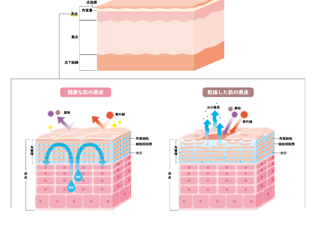 健康な肌の表皮と乾燥した肌の表皮の比較イラスト